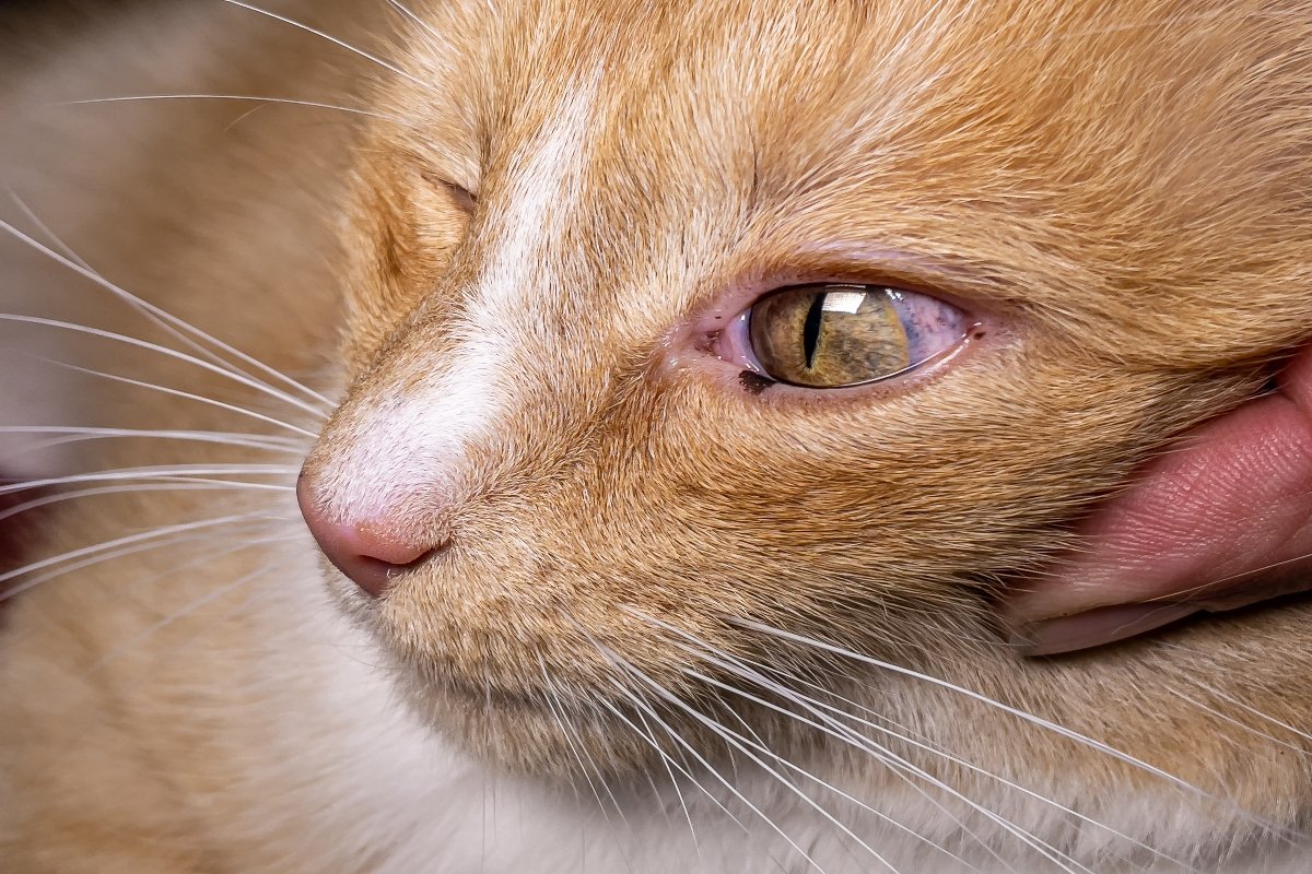 uveitis