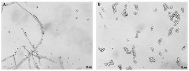 Sporothrix brasiliensis mikroszkóp alatt