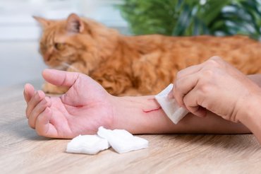 cat scratched this owner